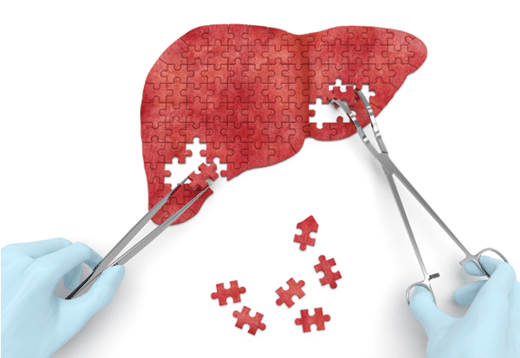 New Advances in Liver Cancer Research