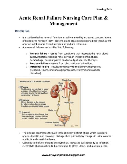 Nursing Considerations for Acute Renal Failure Nursing Considerations for Acute Renal Failure