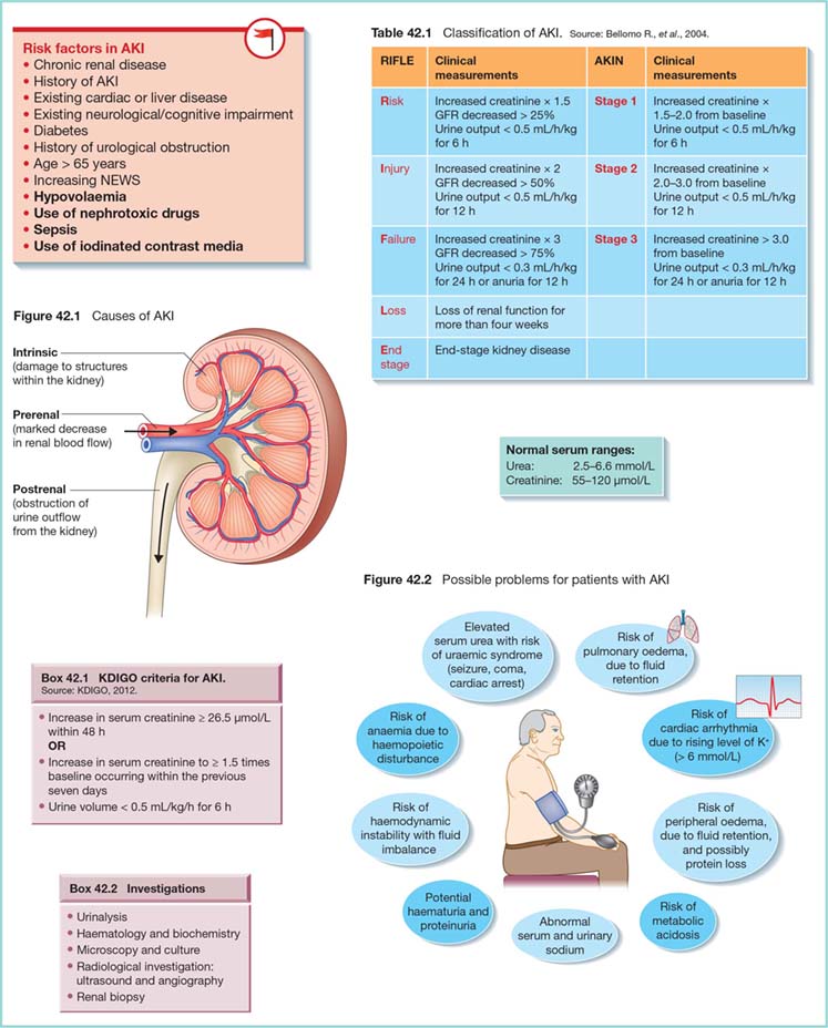 Nursing Considerations for Acute Renal Failure Nursing Considerations for Acute Renal Failure