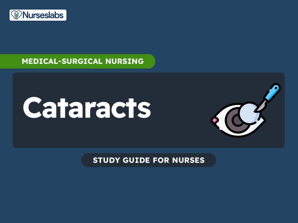 Nursing Considerations for Cataract Surgery