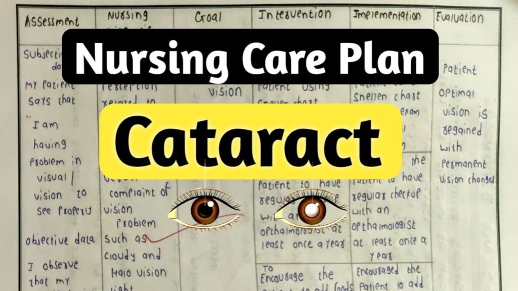 Nursing Considerations for Cataract Surgery