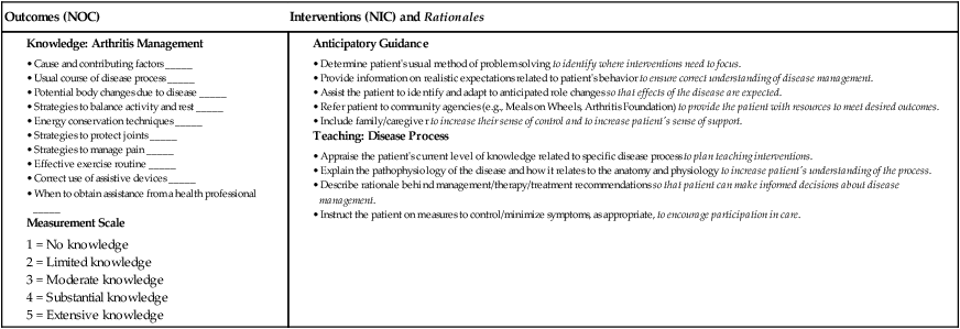 Nursing Considerations for Connective Tissue Disease