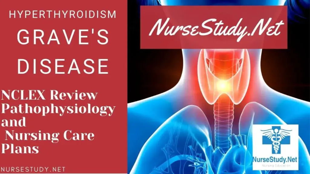 Nursing Considerations for Graves Disease