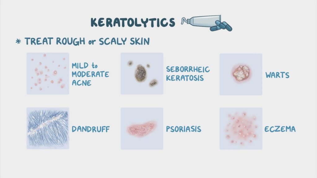Nursing Considerations for Keratosis Pilaris