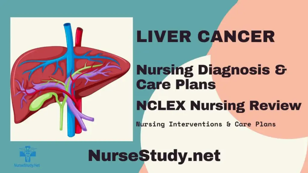 Nursing Considerations for Liver Cancer