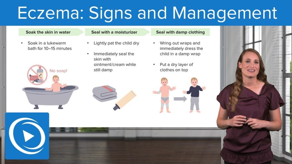 Nursing Considerations for Managing Eczema Nursing Considerations for Managing Eczema