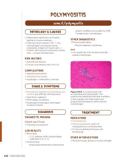 Nursing Considerations for Myositis