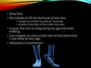 Nursing Considerations for Patients with Foot Drop