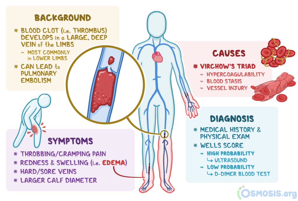 Nursing Considerations for Prevention and Treatment of Blood Clots