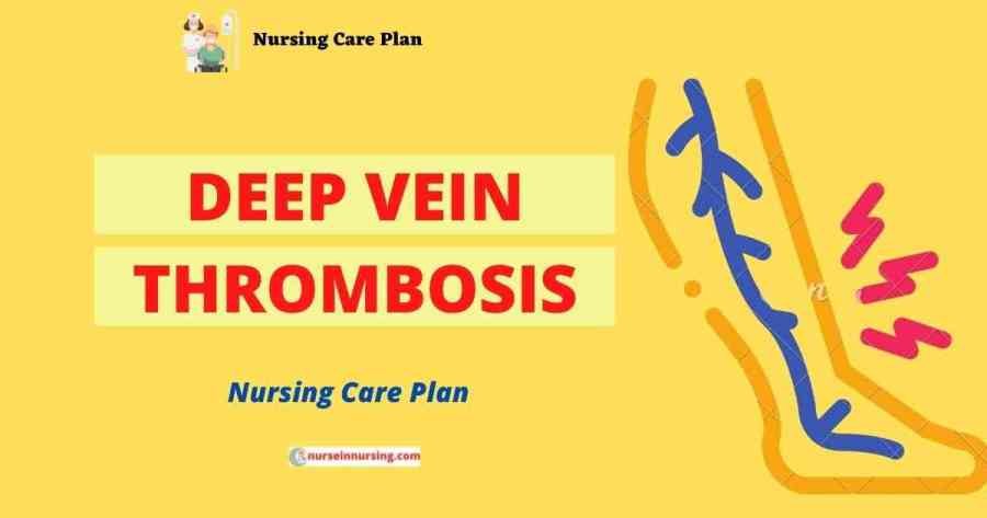 Nursing Considerations for Prevention and Treatment of Blood Clots
