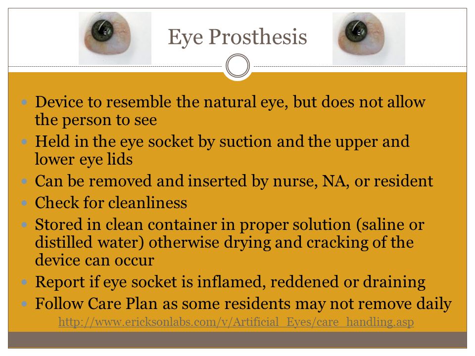 Nursing Considerations for Prosthetic Eye