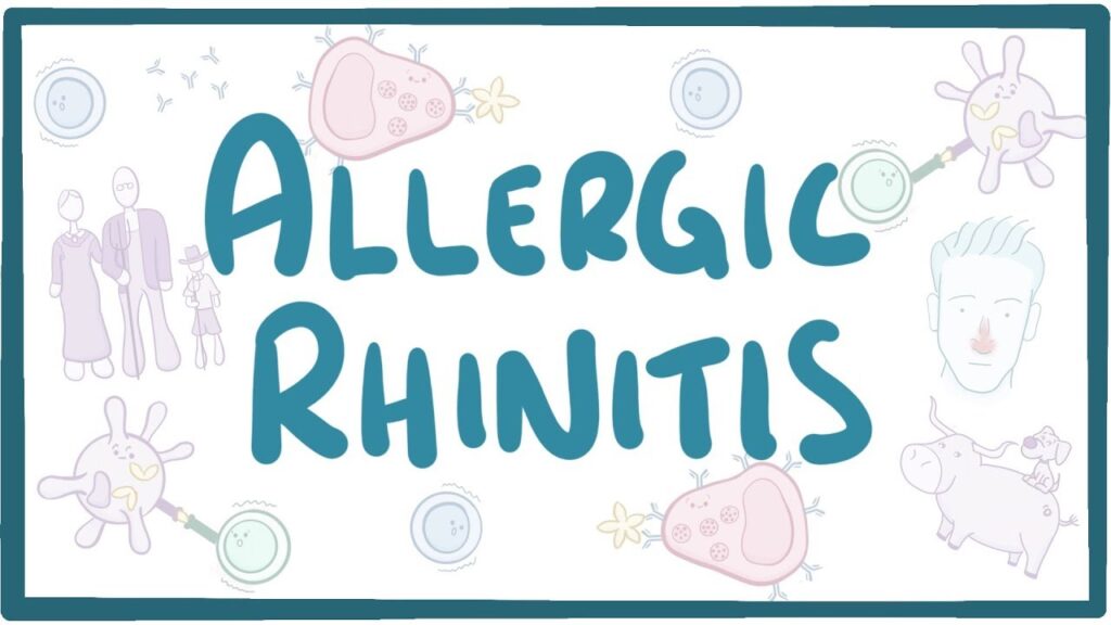 Nursing Considerations for Seasonal Allergies