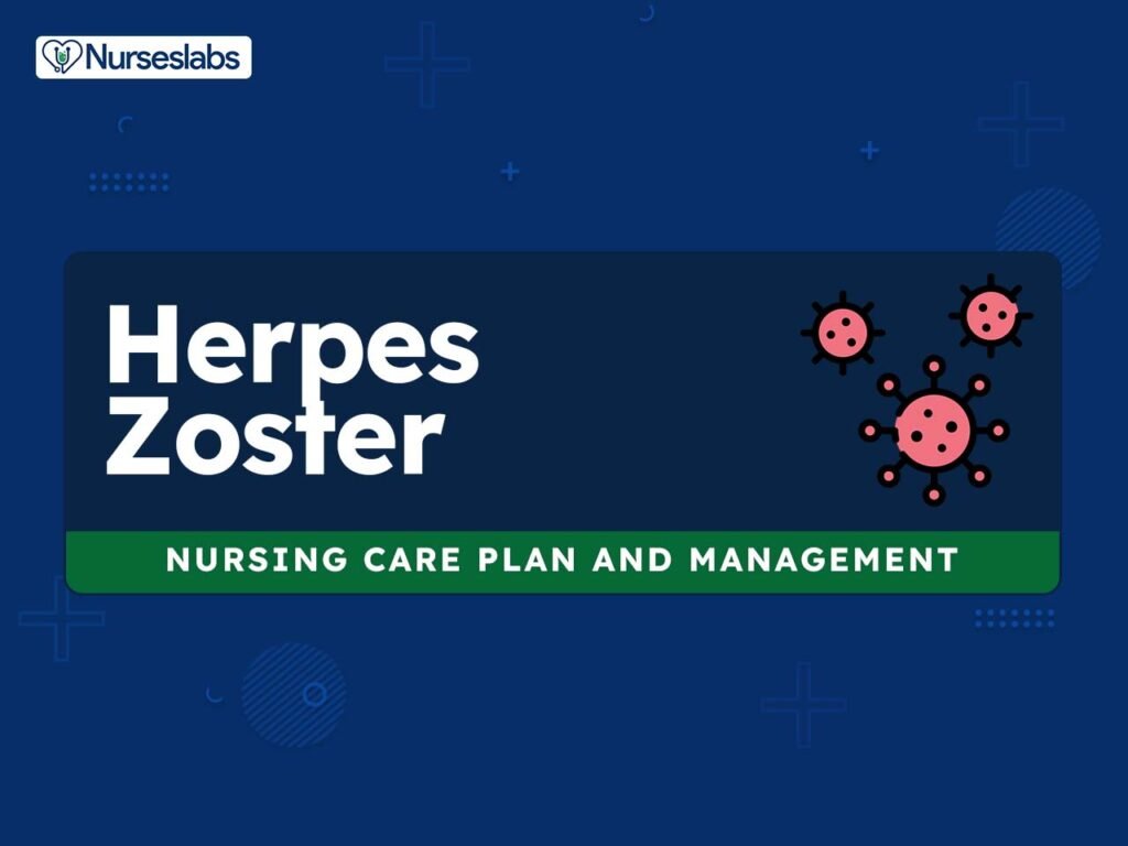 Nursing Considerations for Shingles