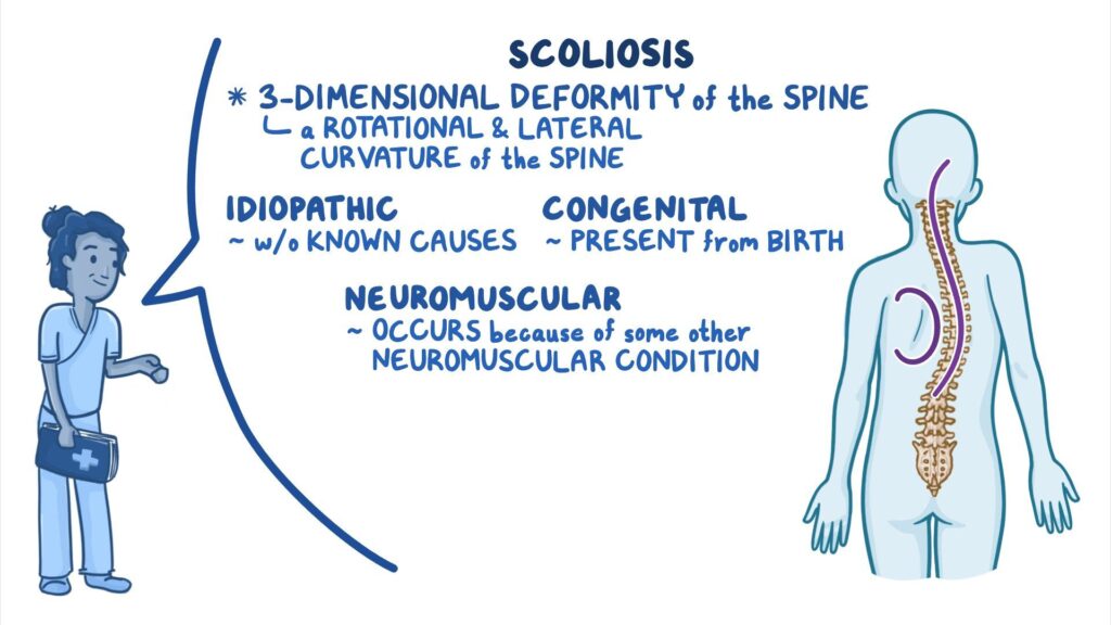 Nursing Considerations for Spine Curvature Disorders