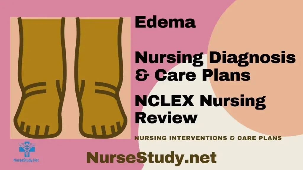 Nursing Considerations for Swollen Feet or Ankles