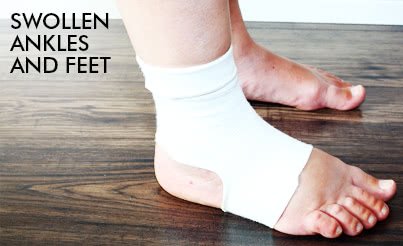 Nursing Considerations for Swollen Feet or Ankles