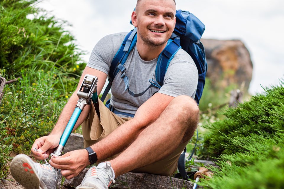 Overcoming Challenges of Amputation