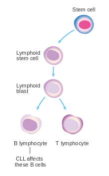 Pregnancy and Chronic Lymphocytic Leukemia