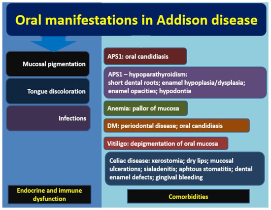 Preventing and Managing Addisons Disease Complications Preventing and Managing Addisons Disease Complications