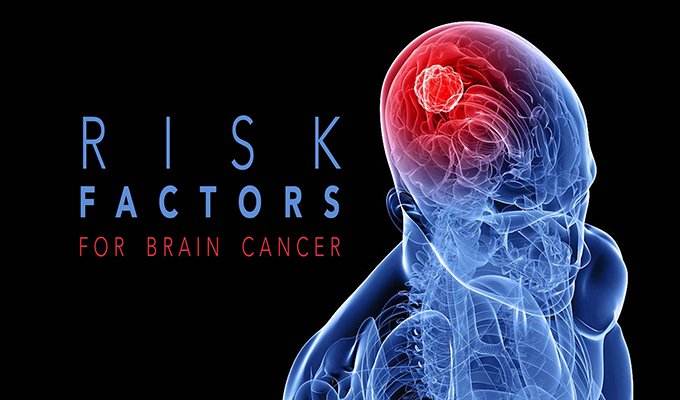 Preventing Brain Tumors: Risk Factors and Prevention