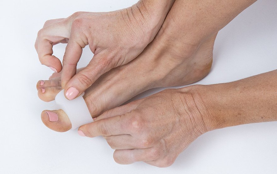 Preventing Bunion Formation - Ask The Nurse Expert