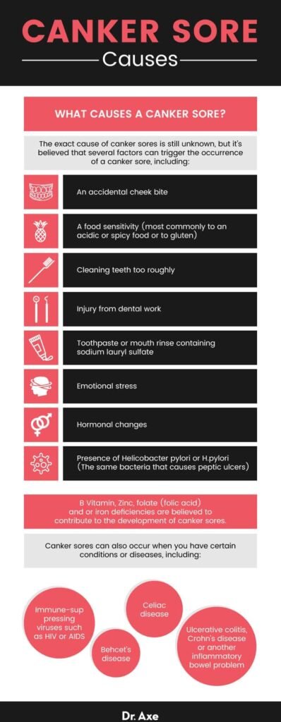 Preventing Canker Sores: Lifestyle Changes That Help