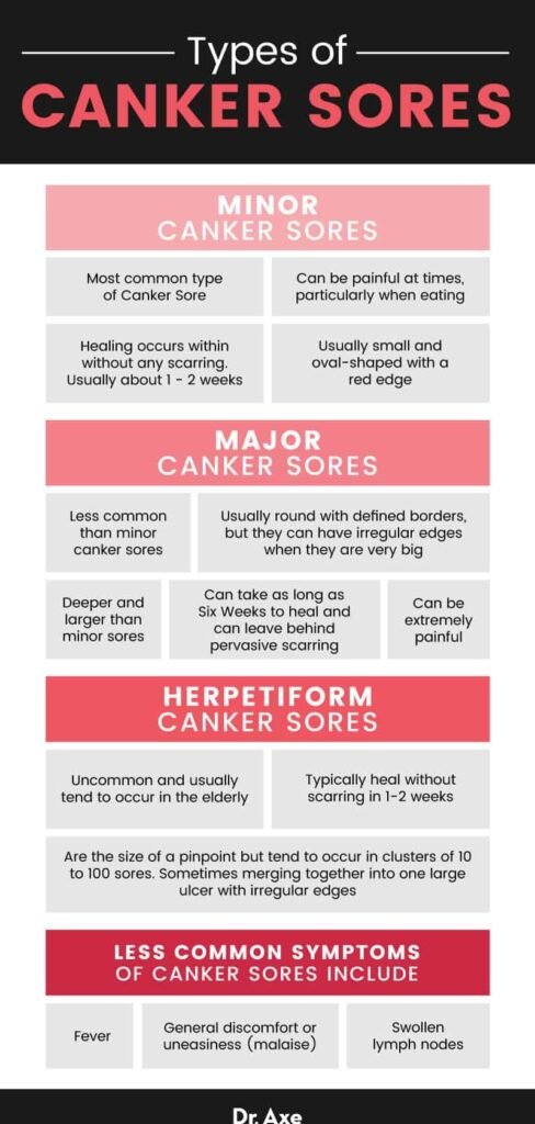 Preventing Canker Sores: Lifestyle Changes That Help