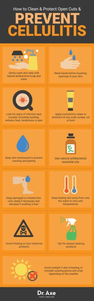 Preventing Cellulitis: Tips for Healthy Skin