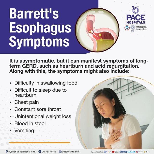 Preventing Complications of Barretts Esophagus