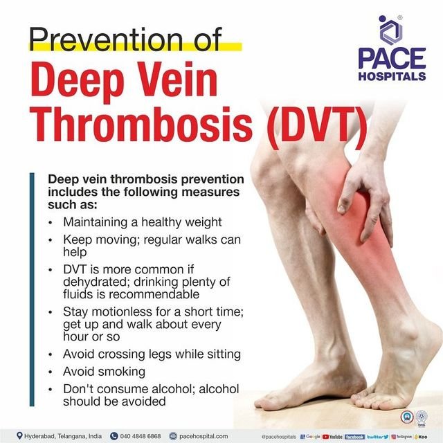 Preventing Deep Vein Thrombosis
