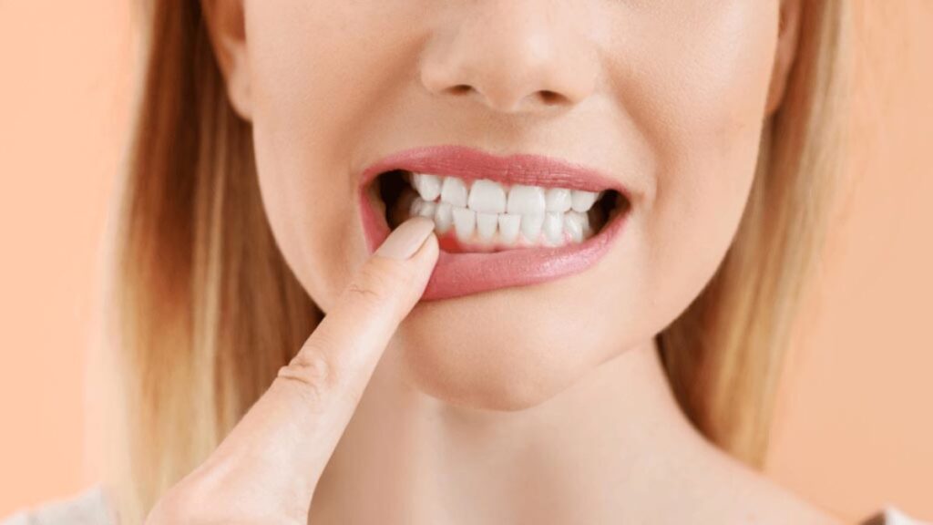 Preventing Dental Abscesses Preventing Dental Abscesses