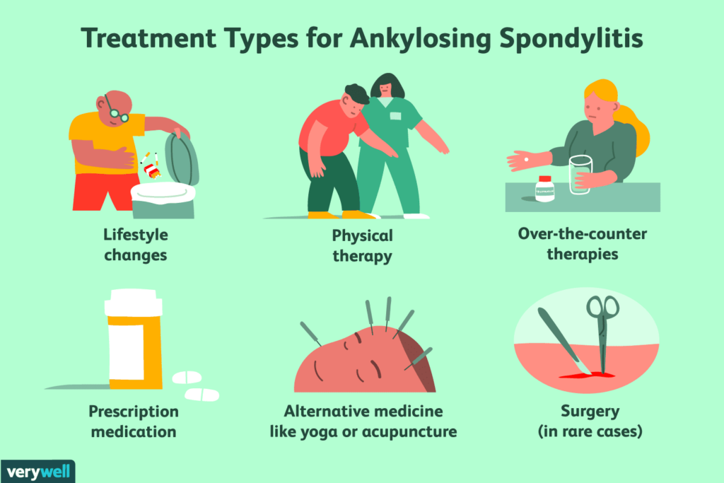 Preventing Disability Progression in Ankylosing Spondylitis: Key Strategies and Therapies