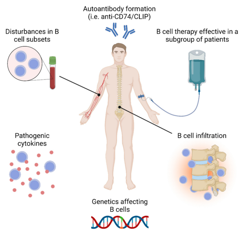 Preventing Disability Progression in Ankylosing Spondylitis: Key Strategies and Therapies