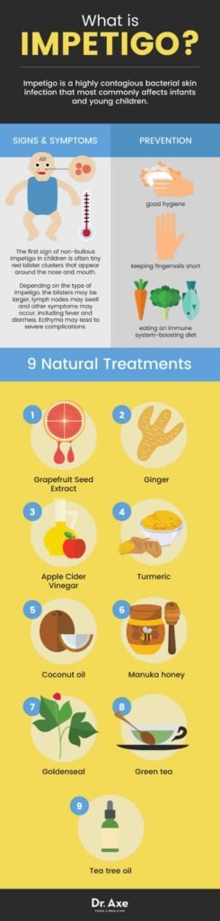 Preventing Impetigo: Effective Strategies and Tips