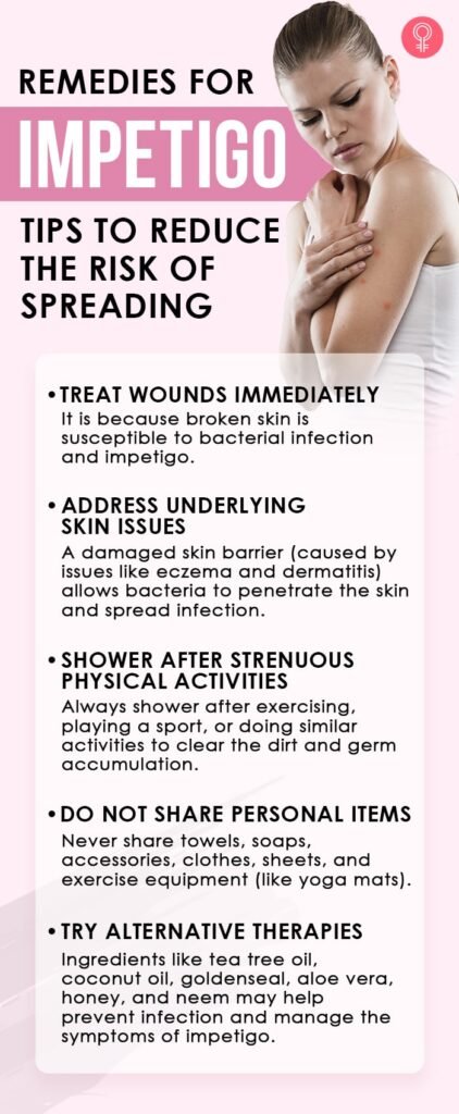 Preventing Impetigo: Effective Strategies and Tips
