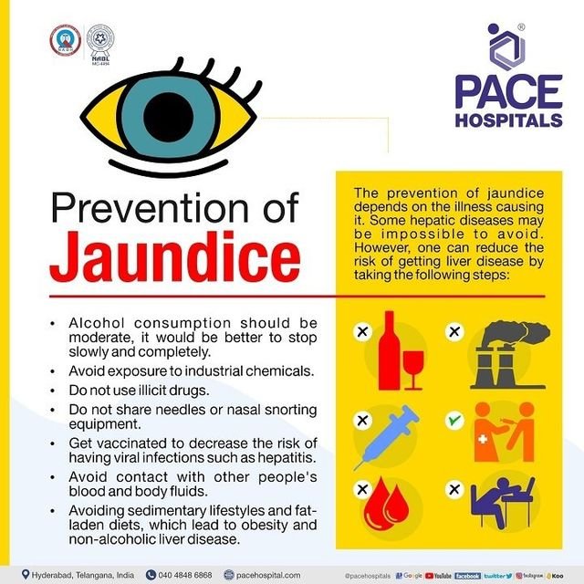 Preventing Jaundice: Easy Lifestyle Changes You Should Make