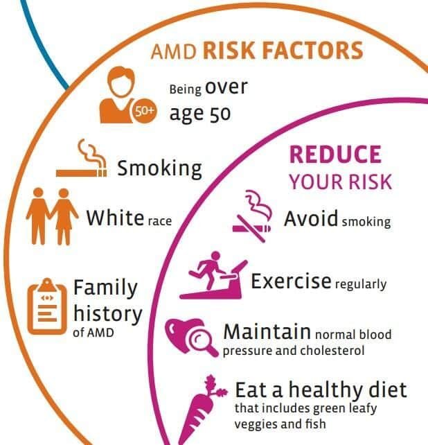 Preventing Macular Degeneration