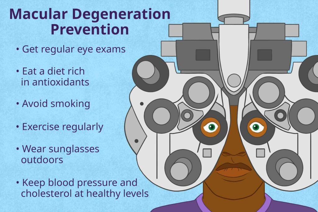 Preventing Macular Degeneration