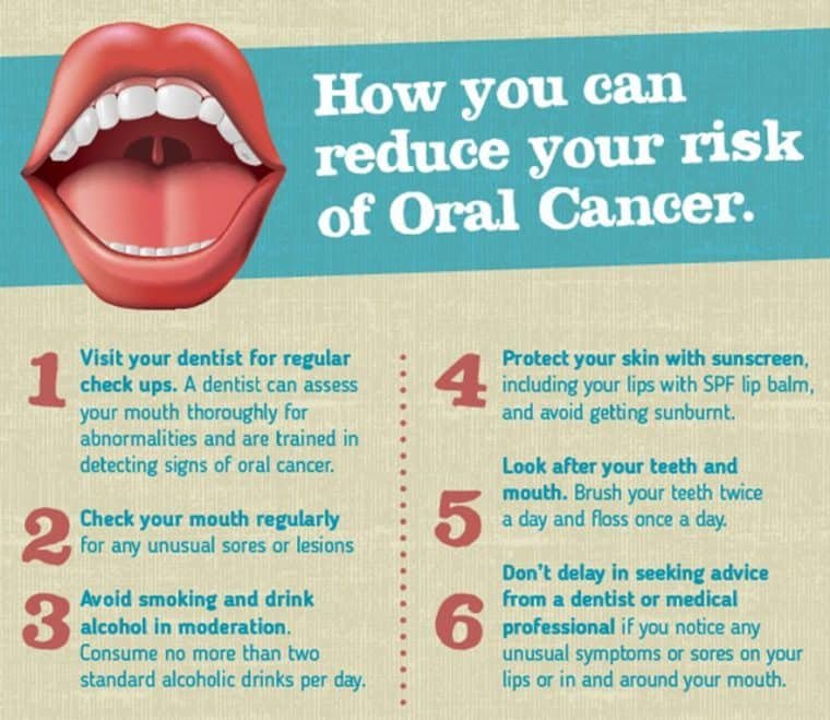 Preventing Mouth Cancer