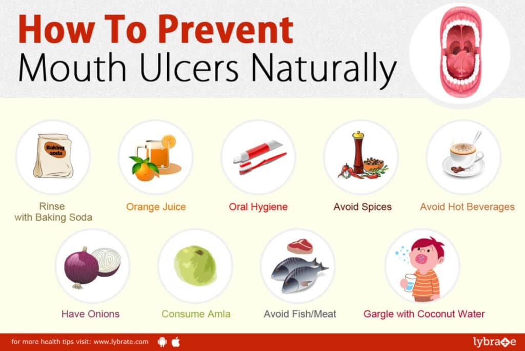 Preventing Mouth Ulcers: Tips and Tricks
