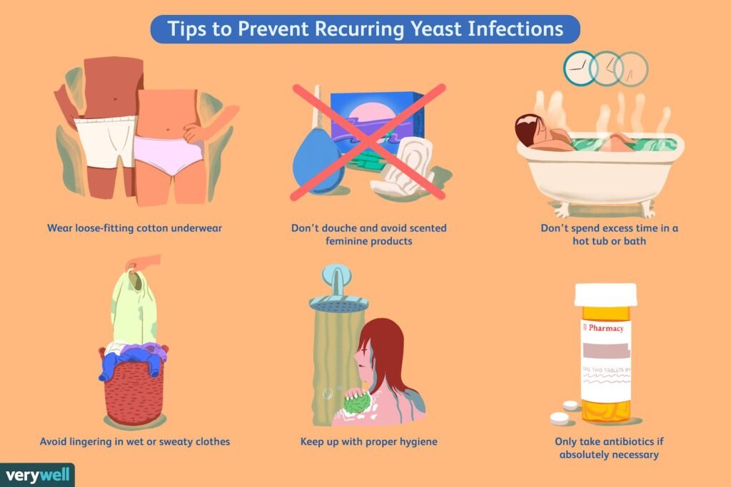 Preventing Yeast Infection: Key Tips