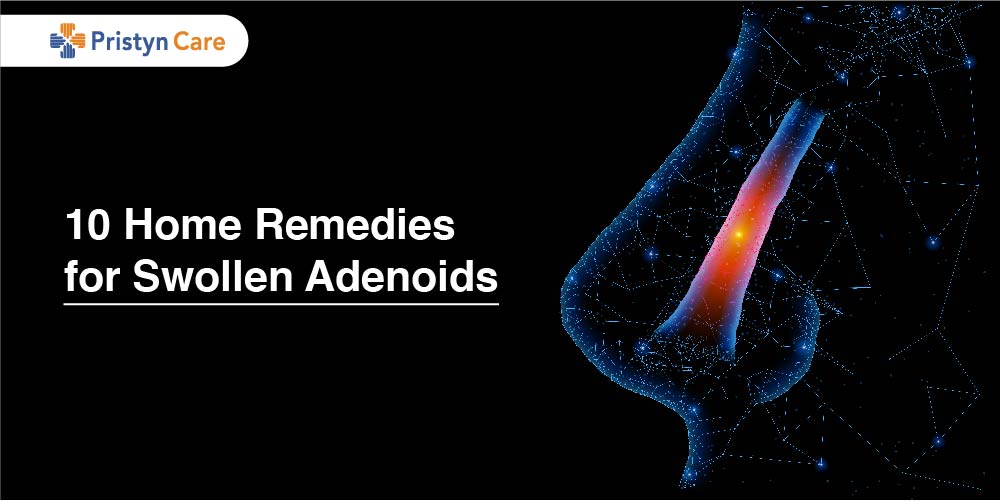 Prevention and Treatment of Adenoiditis Prevention and Treatment of Adenoiditis