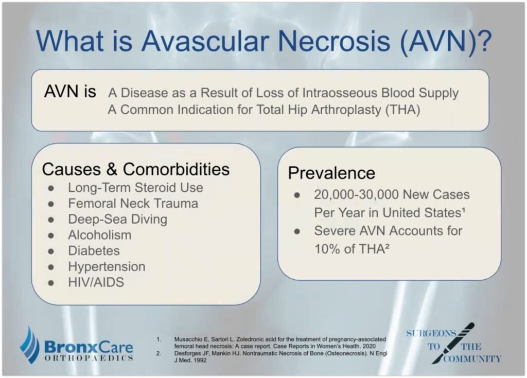 Preventive Measures for Avascular Necrosis