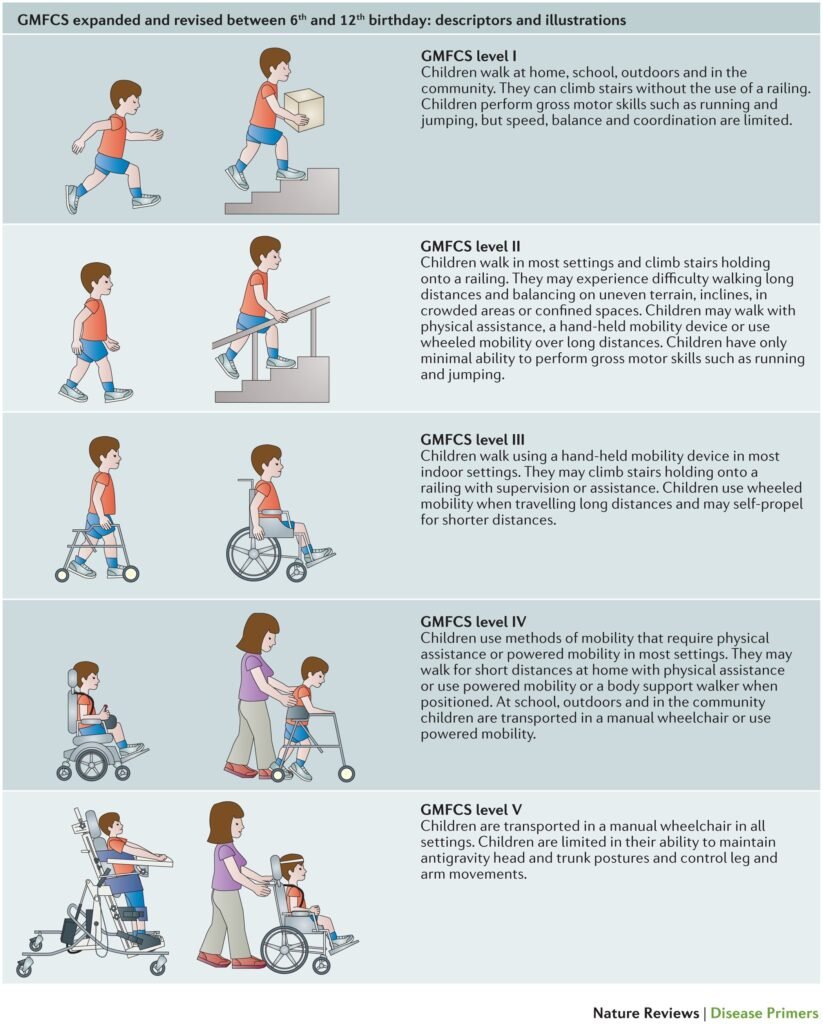 Promising Research Advances in Cerebral Palsy Treatment