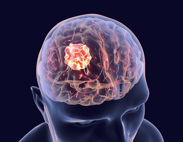 Promising Research on Brain Cancer