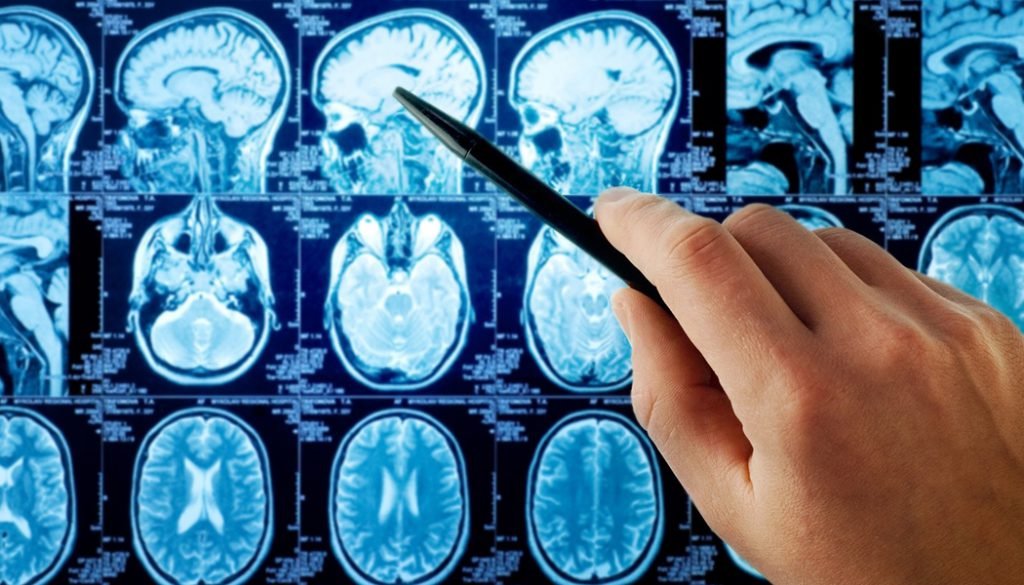 Promising Research on Brain Cancer