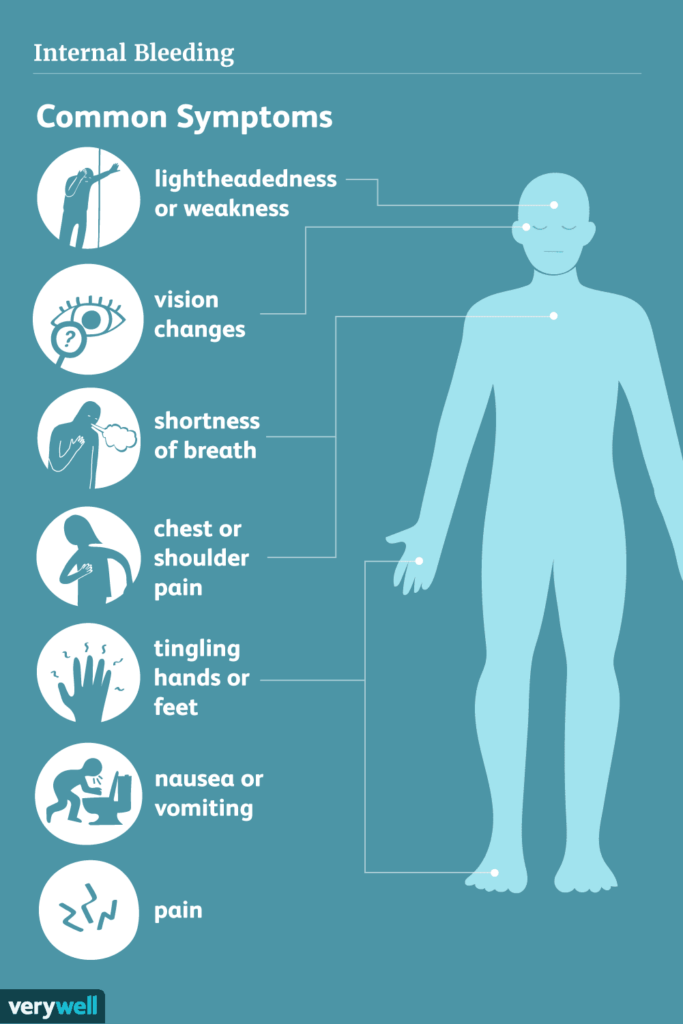 Promoting Recovery from Internal Bleeding