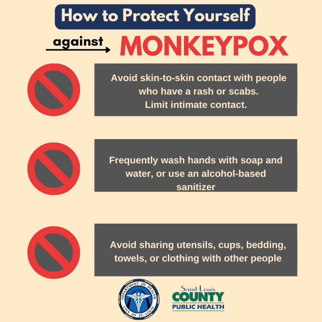 Protect Yourself: How to Stay Safe from Monkeypox