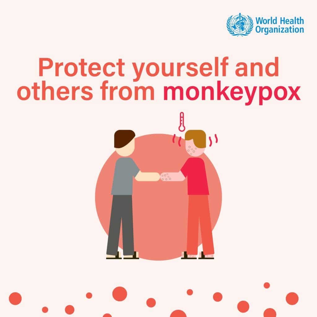 Protect Yourself: How to Stay Safe from Monkeypox