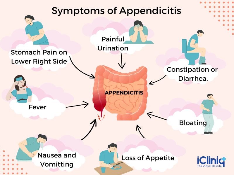 Risk Factors And Precautions For Appendicitis